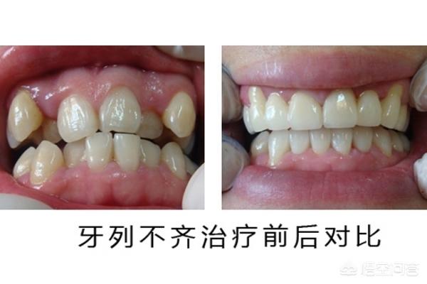 长兴最新24小时牙医在线咨询方法分析(最方便真实的长兴有没有24小时牙医方法)